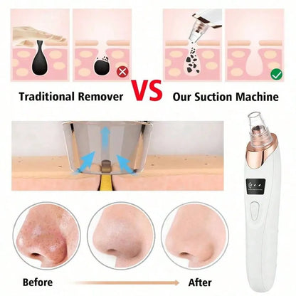 ClearSkin Pore Vacuum