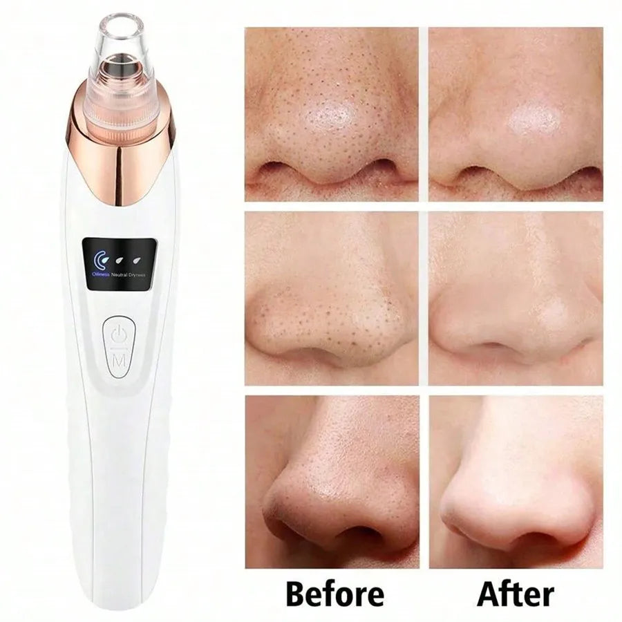 ClearSkin Pore Vacuum