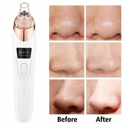 ClearSkin Pore Vacuum